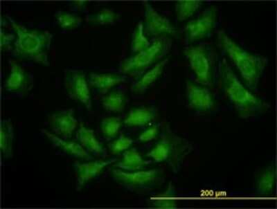 Immunocytochemistry/ Immunofluorescence: SMURF1 Antibody (1D7) [H00057154-M01]