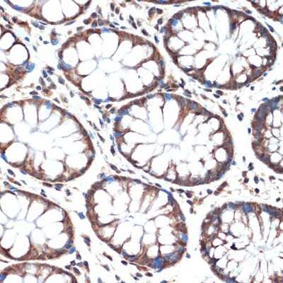 Immunohistochemistry-Paraffin: SMURF2 Antibody (8O7F0) [NBP3-16105]