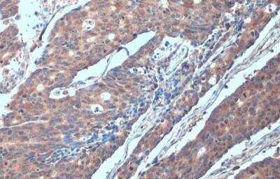 Immunohistochemistry-Paraffin: SMURF2 Antibody [NBP2-20427]