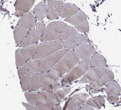 Immunohistochemistry-Paraffin: SMURF2 Antibody [NBP2-57554]