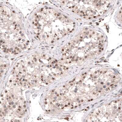 Immunohistochemistry-Paraffin: SMYD2 Antibody [NBP1-83186]