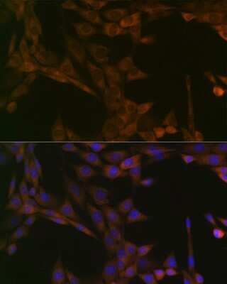 Immunocytochemistry/ Immunofluorescence: SMYD3 Antibody (2P8Z2) [NBP3-16102]