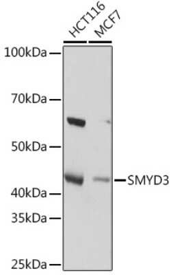 Western Blot: SMYD3 Antibody (2P8Z2) [NBP3-16102]