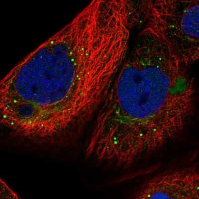Immunocytochemistry/ Immunofluorescence: SMYD4 Antibody [NBP1-81356]