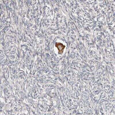 Immunohistochemistry-Paraffin: SMYD4 Antibody [NBP1-81356]