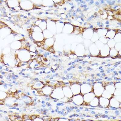 Immunohistochemistry-Paraffin: SMYD4 Antibody - BSA Free [NBP2-93044]