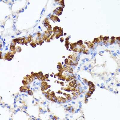 Immunohistochemistry-Paraffin: SMYD4 Antibody - BSA Free [NBP2-93044]