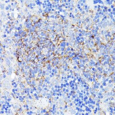 Immunohistochemistry-Paraffin: SMYD4 Antibody - BSA Free [NBP2-93044]