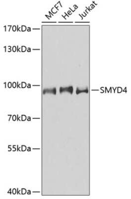 Western Blot: SMYD4 AntibodyAzide and BSA Free [NBP3-04603]