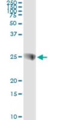 Immunoprecipitation: SNAP23 Antibody (2F5-3D4) [H00008773-M01]