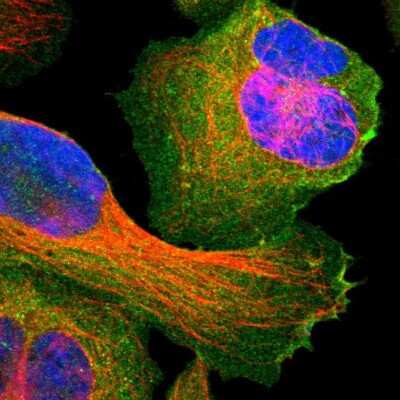 Immunocytochemistry/ Immunofluorescence: SNAP23 Antibody [NBP1-83162]