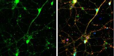 Immunocytochemistry/ Immunofluorescence: SNAP23 Antibody [NBP2-20434]