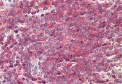 Immunohistochemistry-Paraffin: SNAP23 Antibody [NBP1-49855]