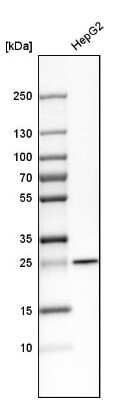 Western Blot: SNAP23 Antibody [NBP1-83162]