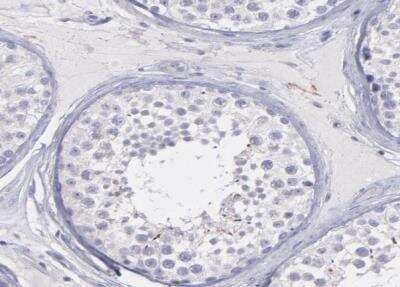 Immunohistochemistry-Paraffin: SNAP25 Antibody [NBP1-88769]