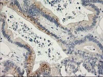 Immunohistochemistry: SNAP25 Antibody (OTI4G5) - Azide and BSA Free [NBP2-74245]
