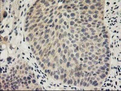 Immunohistochemistry: SNAP25 Antibody (OTI4G5) - Azide and BSA Free [NBP2-74245]