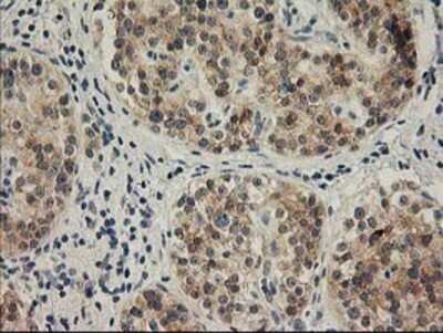 Immunohistochemistry: SNAP25 Antibody (OTI4G5) - Azide and BSA Free [NBP2-74245]