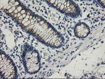 Immunohistochemistry: SNAP25 Antibody (OTI4G5) - Azide and BSA Free [NBP2-74245]