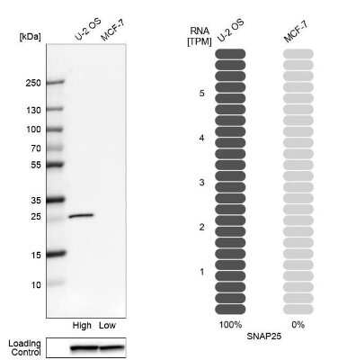Western Blot: SNAP25 Antibody [NBP1-88769]