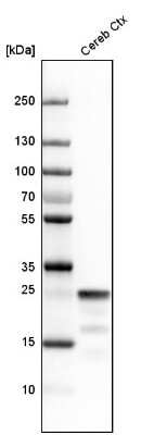 Western Blot: SNAP25 Antibody [NBP1-88769]