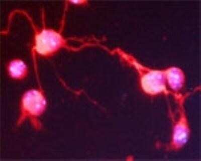 Immunocytochemistry/ Immunofluorescence: SNAP25 Interacting Protein Antibody [NBP1-03414]