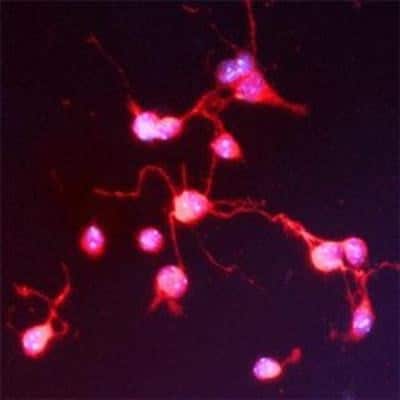 Immunocytochemistry/ Immunofluorescence: SNAP25 Interacting Protein Antibody [NBP1-03414]