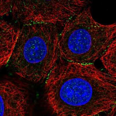 Immunocytochemistry/ Immunofluorescence: SNAP25 Interacting Protein Antibody [NBP2-39005]