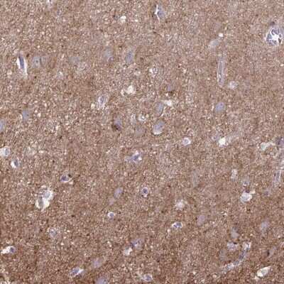 Immunohistochemistry-Paraffin: SNAP25 Interacting Protein Antibody [NBP2-39005]
