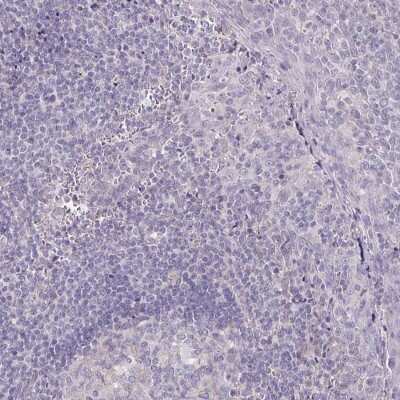 Immunohistochemistry-Paraffin: SNAP25 Interacting Protein Antibody [NBP2-39005]