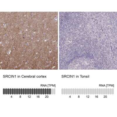 Immunohistochemistry-Paraffin: SNAP25 Interacting Protein Antibody [NBP2-39005]