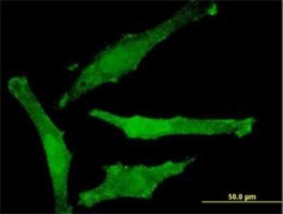 Immunocytochemistry/ Immunofluorescence: SNAP29 Antibody (3E4-E6) [H00009342-M01]