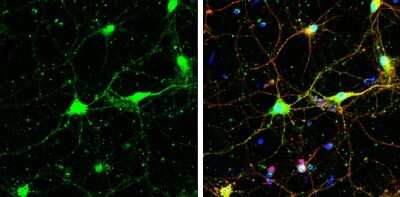 Immunocytochemistry/ Immunofluorescence: SNAP29 Antibody [NBP3-12979]