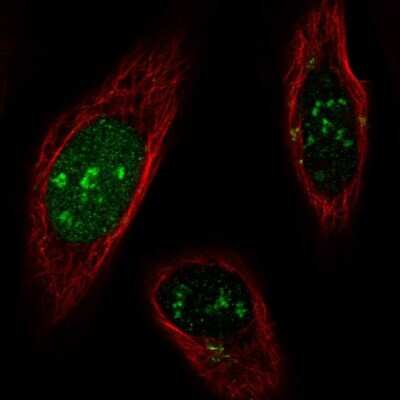 Immunocytochemistry/ Immunofluorescence: SNAP43 Antibody [NBP2-68849]