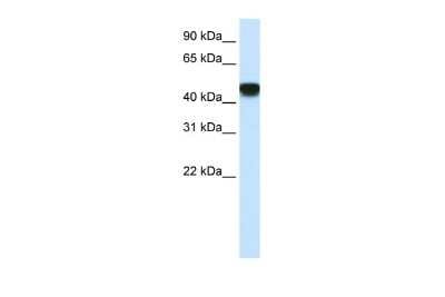 Western Blot: SNAP43 Antibody [NBP2-88319]