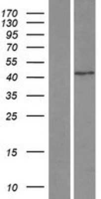 Western Blot: SNAP43 Overexpression Lysate [NBL1-16270]