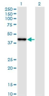 Western Blot: SNAP45 Antibody (4B8) [H00006618-M01]