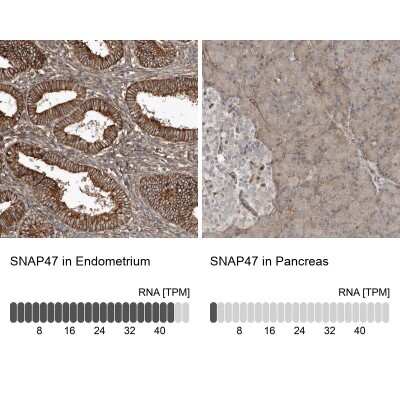 Immunohistochemistry-Paraffin: SNAP47 Antibody [NBP1-88483]