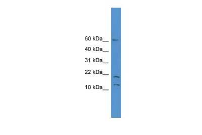 Western Blot: SNAPC5 Antibody [NBP3-09361]