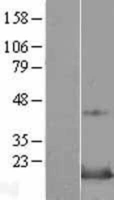 Western Blot: Snapin Overexpression Lysate [NBL1-16273]
