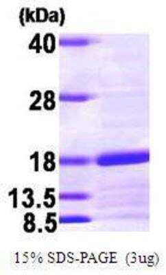 SDS-PAGE: Recombinant Human Snapin His Protein [NBC1-22575]