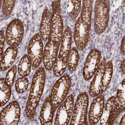 Immunohistochemistry: SNED1 Antibody [NBP1-92416]