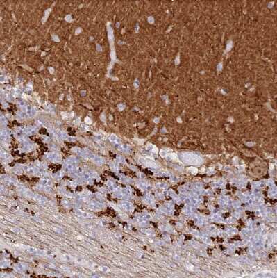 Immunohistochemistry-Paraffin: SNED1 Antibody [NBP1-92415]