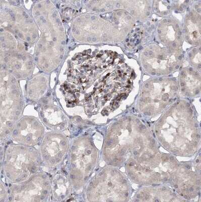 Immunohistochemistry-Paraffin: SNED1 Antibody [NBP1-92415]
