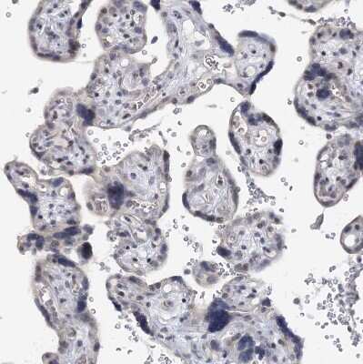 Immunohistochemistry-Paraffin: SNED1 Antibody [NBP1-92415]