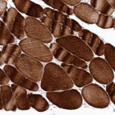 Immunohistochemistry-Paraffin: SNED1 Antibody [NBP1-92415]