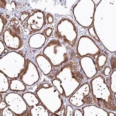 Immunohistochemistry-Paraffin: SNED1 Antibody [NBP1-92415]