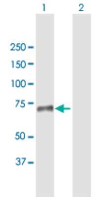 Western Blot: SNED1 Antibody [H00025992-B01P]