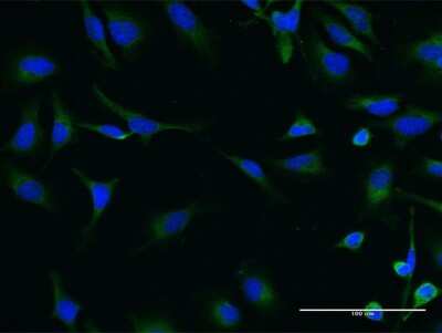 Immunocytochemistry/ Immunofluorescence: SNF1LK2/SIK2 Antibody (4C6) [H00023235-M03]
