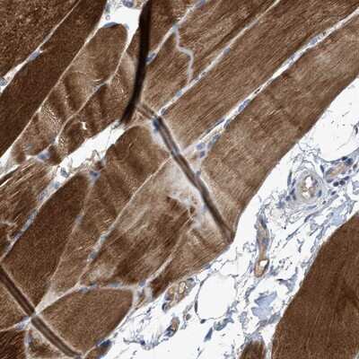 Immunohistochemistry-Paraffin: SNF1LK2/SIK2 Antibody [NBP1-85114]